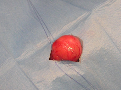 chirurgie perineální oblasti